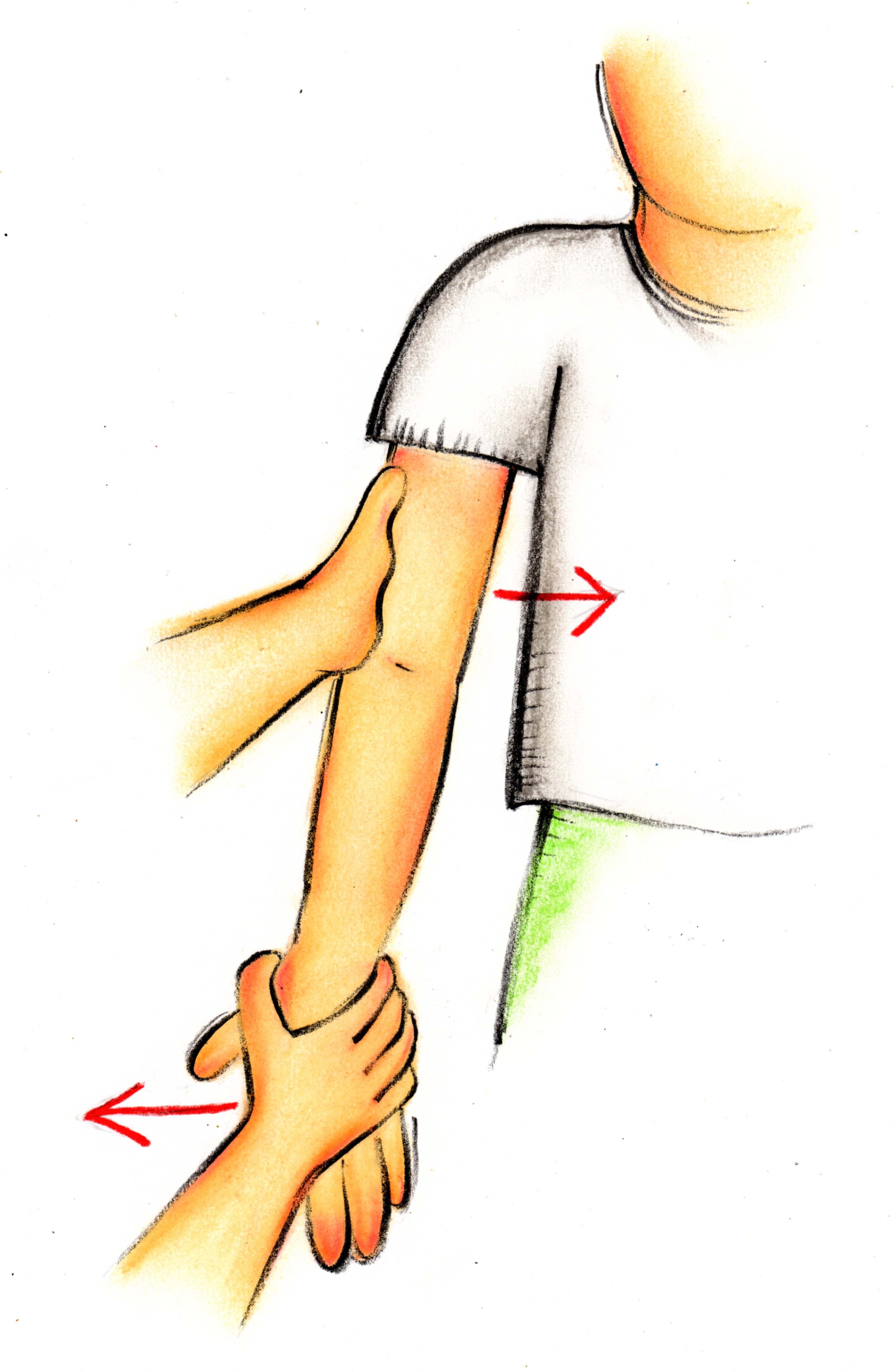 外傷性外側側副靭帯損傷 肘 トレシピ