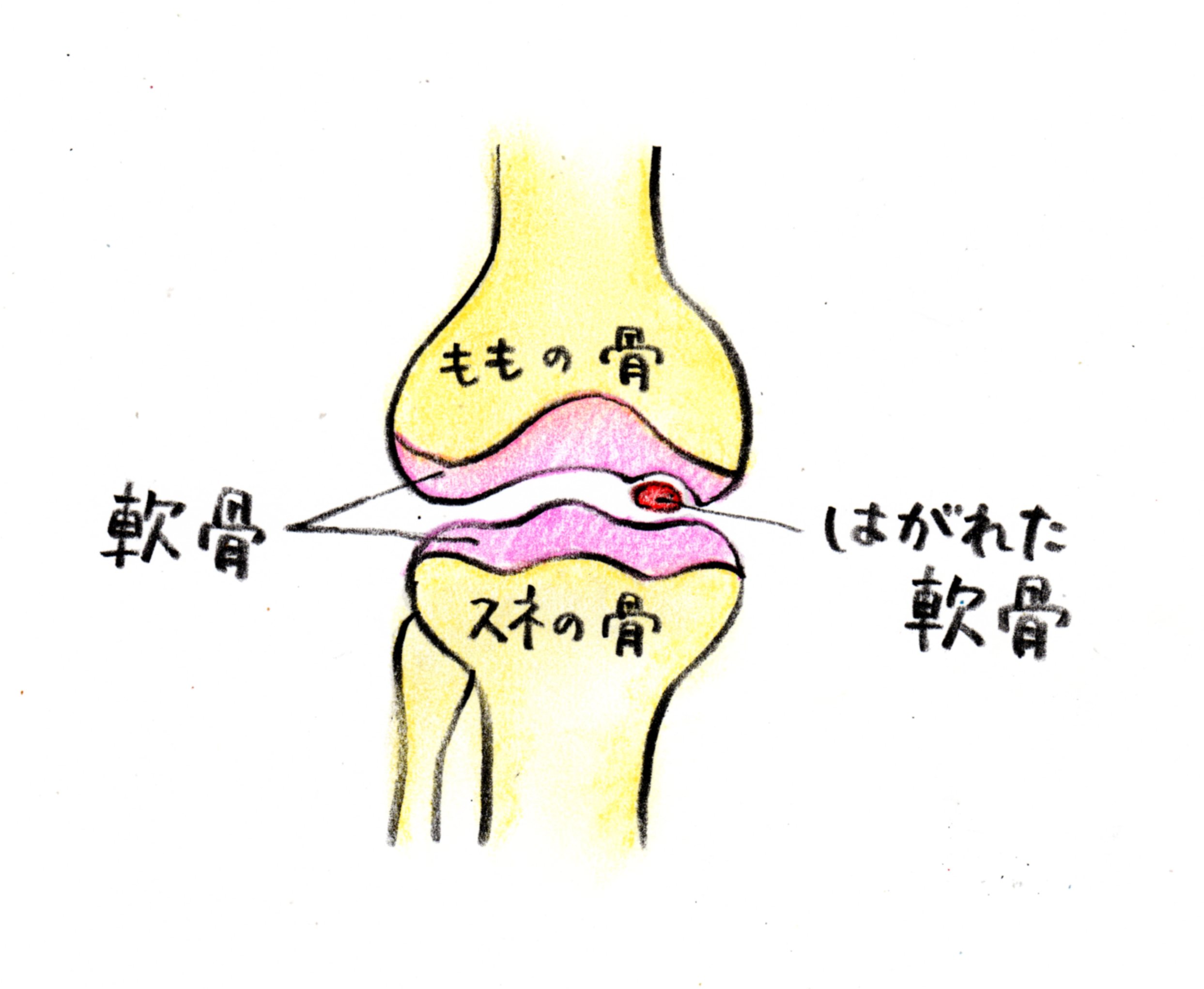 症状