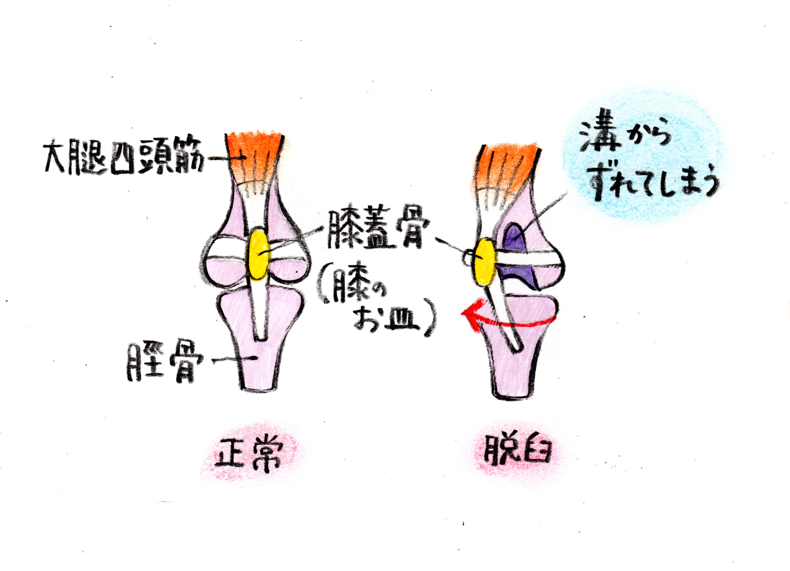 症状