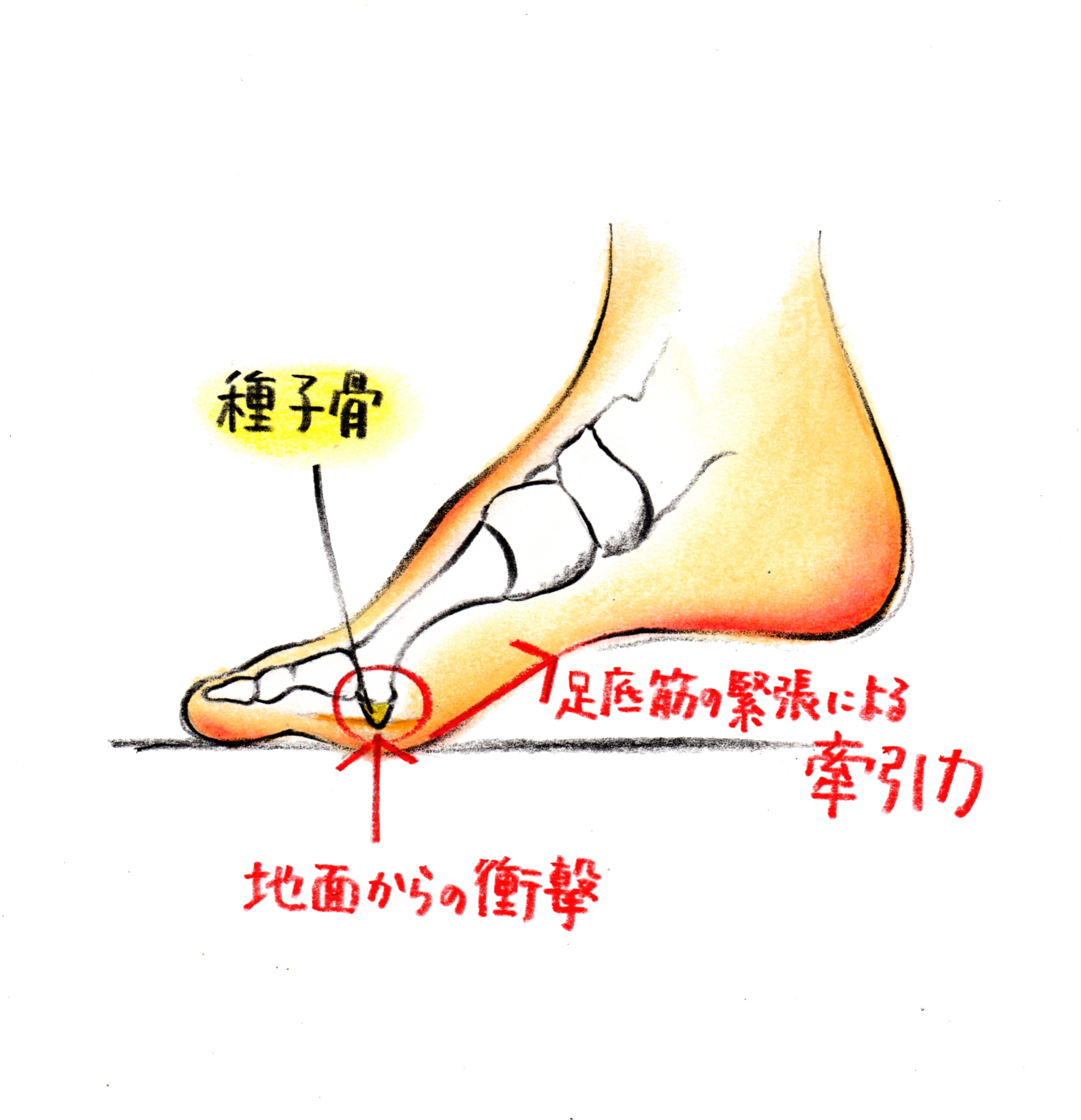 原因